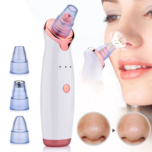 Electric Suction Blackhead Remover - Beeyouti